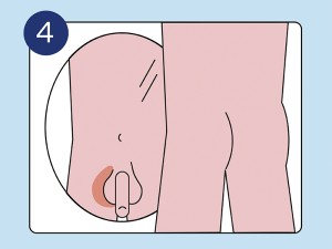 Selbstuntersuchung: Hoden im Spiegel anschauen