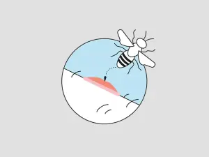 Illustration einer Biene und deren Stich