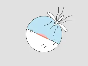 Illustration einer Stechmücke und deren Stich